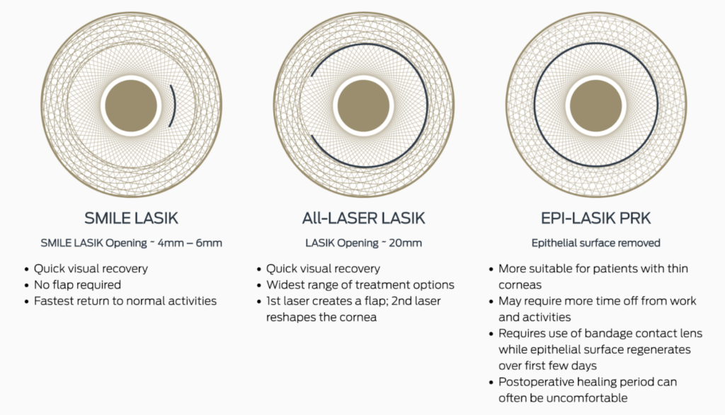 3 Different Types of LASIK graphic: SMILE LASIK, All-LASER LASIK & EPI-LASIK PRK